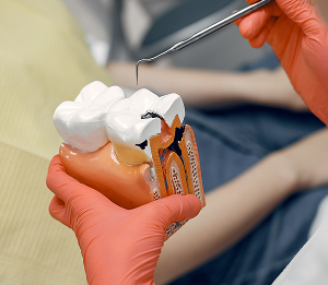 В декабре при лечении любого кариеса у первичного пациента чистка всех зубов ультразвуком в подарок!